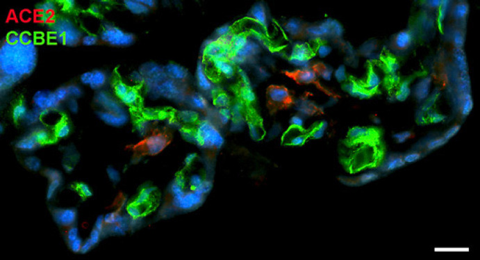 Immunofluorescence Studies on the Expression of the SARS-CoV-2 Receptors in Human Term Placenta.