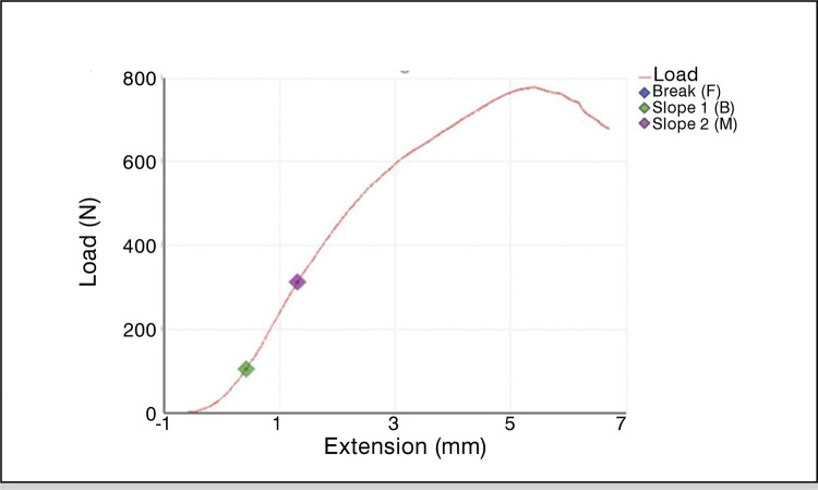 FIXATION METHODS IN LATARJET: BIOMECHANICAL COMPARISON OF SCREW TYPES AND PLATE FIXATION.