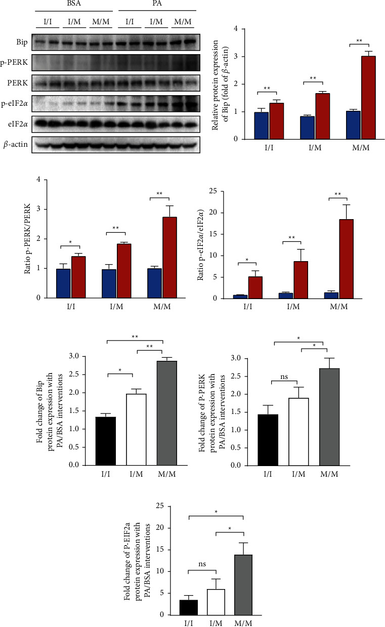 PNPLA3 148M/M Is More Susceptible to Palmitic Acid-Induced Endoplasmic Reticulum Stress-Associated Apoptosis in HepG2 Cells.