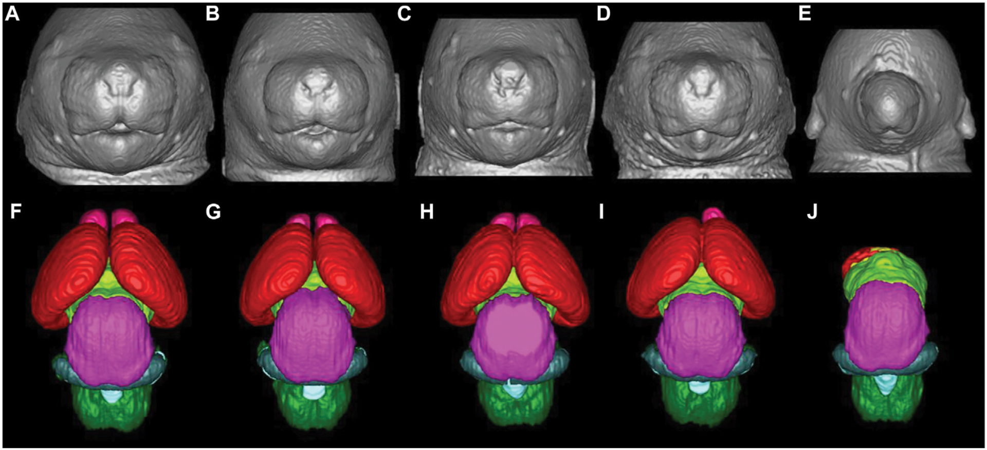 High-resolution imaging in studies of alcohol effect on prenatal development.