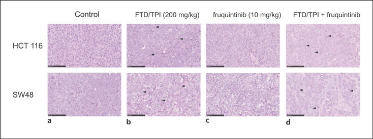 Evaluation of a Novel Combination Therapy, Based on Trifluridine/Tipiracil and Fruquintinib, against Colorectal Cancer.