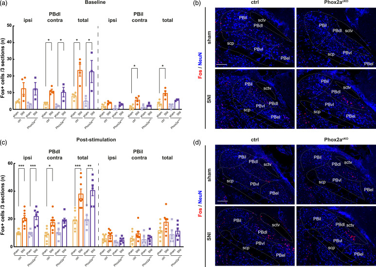 Genetic evidence of the function of Phox2a-expressing anterolateral system neurons in the transmission of chronic pain.