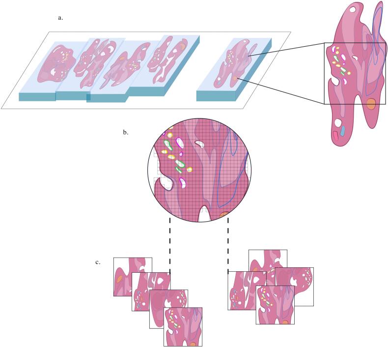 An update on computational pathology tools for genitourinary pathology practice: A review paper from the Genitourinary Pathology Society (GUPS)