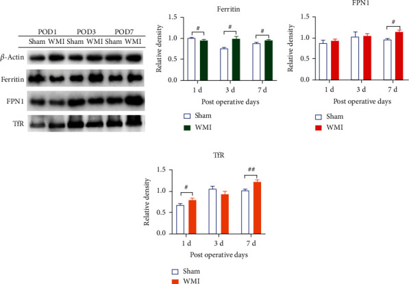 Effect of Hypoxia-Ischemia on the Expression of Iron-Related Proteins in Neonatal Rat Brains.