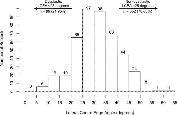 Developmental dysplasia of the hip is common in patients undergoing total hip arthroplasty under 50 years of age.