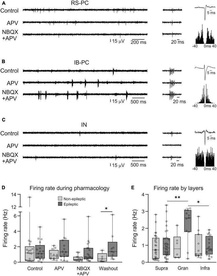 Synaptic alterations and neuronal firing in human epileptic neocortical excitatory networks.