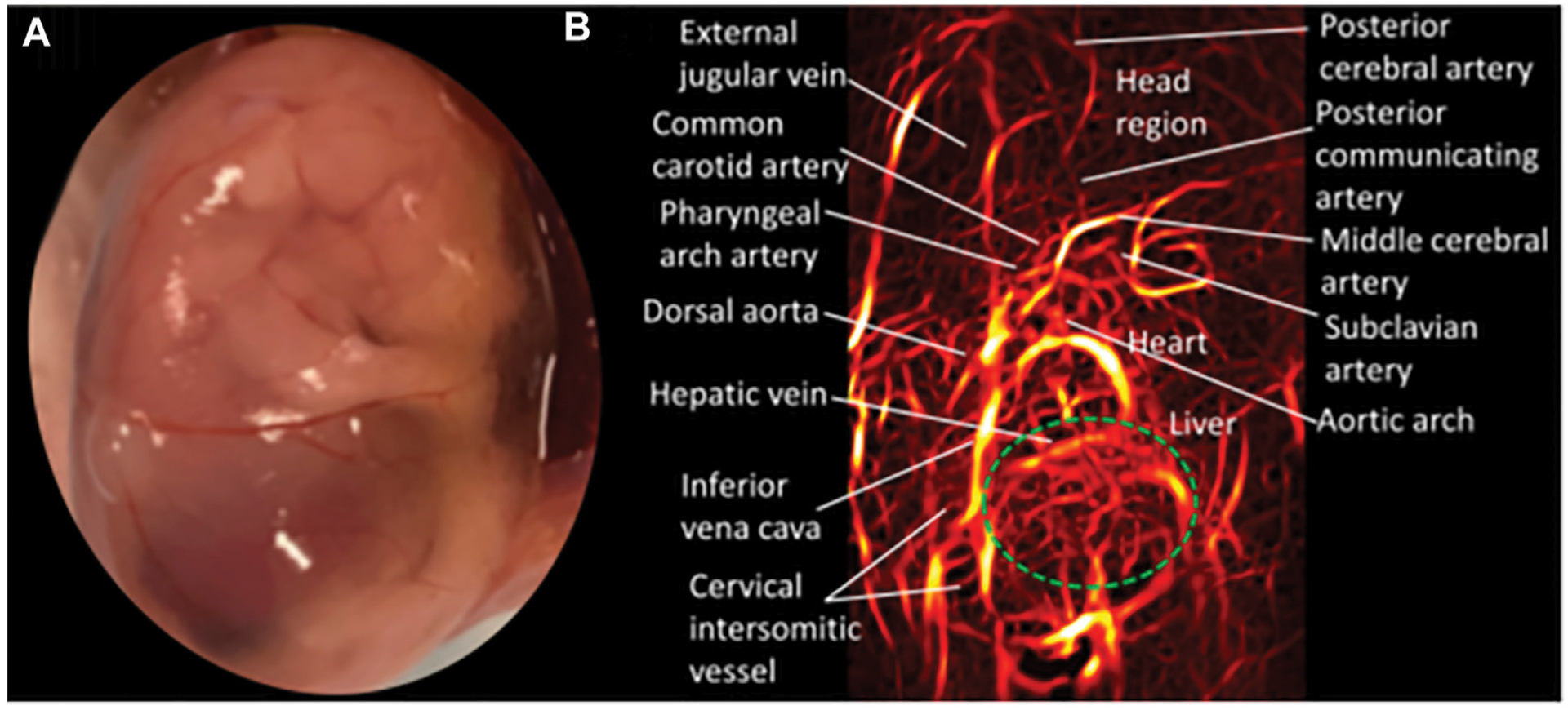 High-resolution imaging in studies of alcohol effect on prenatal development.