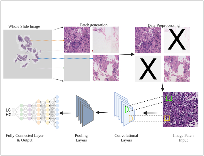 Differentiation of urothelial carcinoma in histopathology images using deep learning and visualization