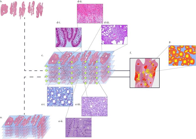 An update on computational pathology tools for genitourinary pathology practice: A review paper from the Genitourinary Pathology Society (GUPS)