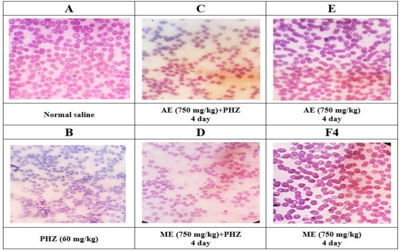 The hematopoietic potential of methanolic and aqueous extracts of <i>Portulaca oleracea</i> in a phenylhydrazine model of anemia.