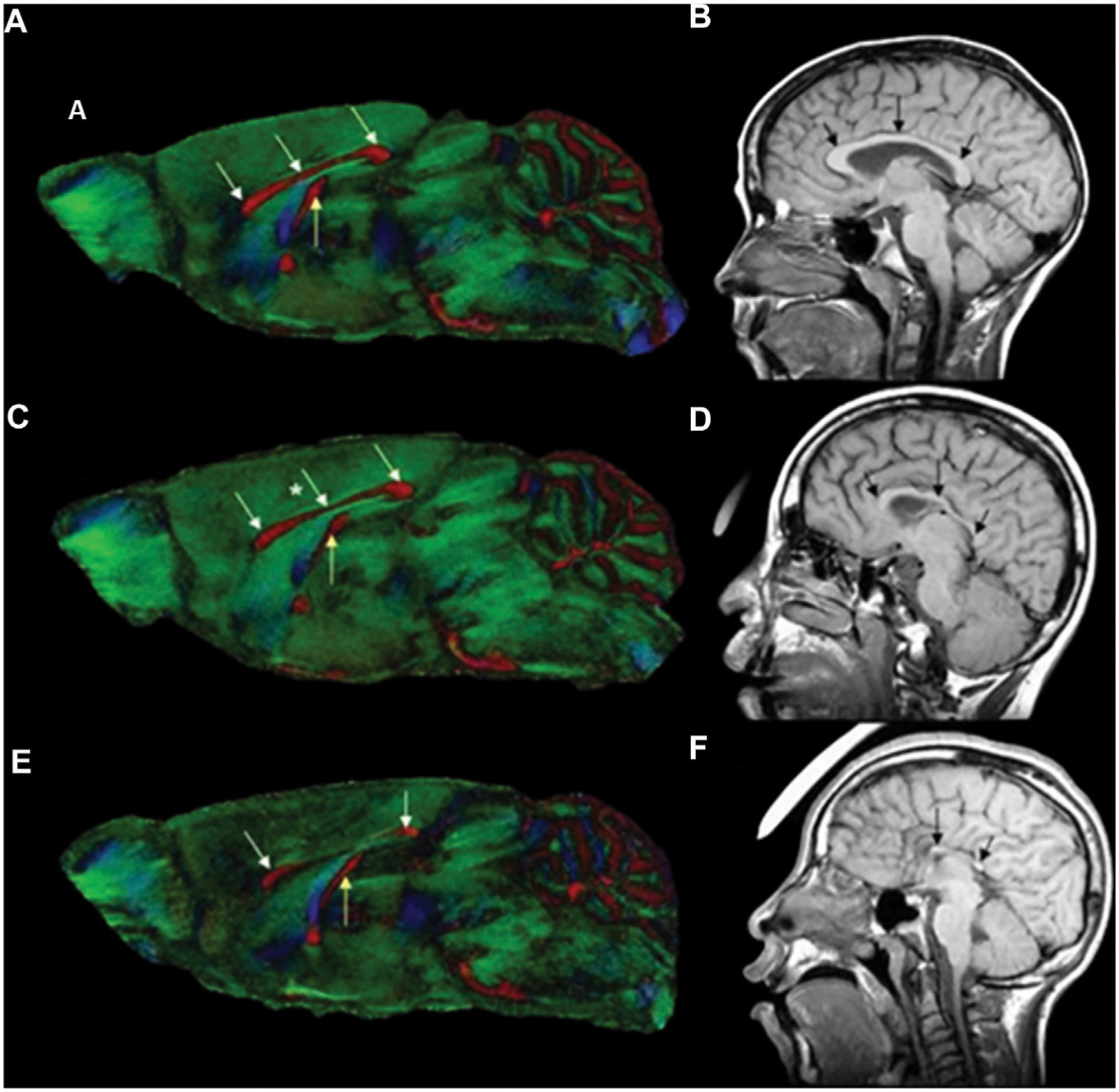 High-resolution imaging in studies of alcohol effect on prenatal development.