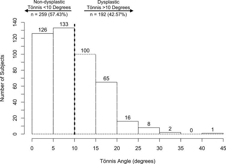 Developmental dysplasia of the hip is common in patients undergoing total hip arthroplasty under 50 years of age.