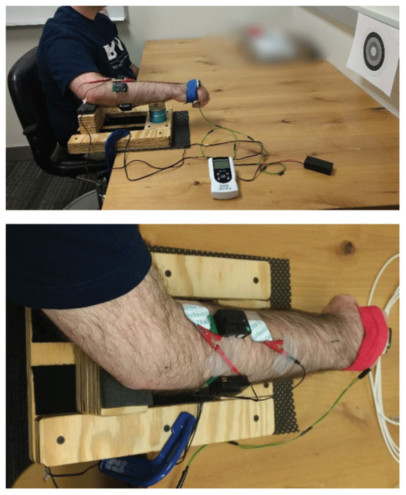 Brief Submotor-Threshold Electrical Stimulation Applied Synchronously Over Wrist Flexor and Extensor Muscles does Not Suppress Essential Tremor, Independent of Stimulation Frequency.