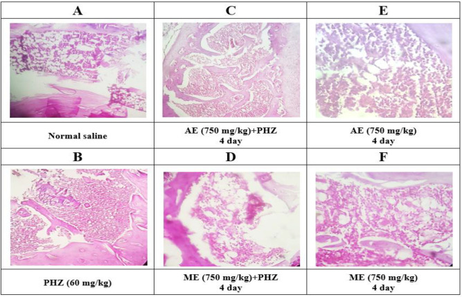 The hematopoietic potential of methanolic and aqueous extracts of <i>Portulaca oleracea</i> in a phenylhydrazine model of anemia.