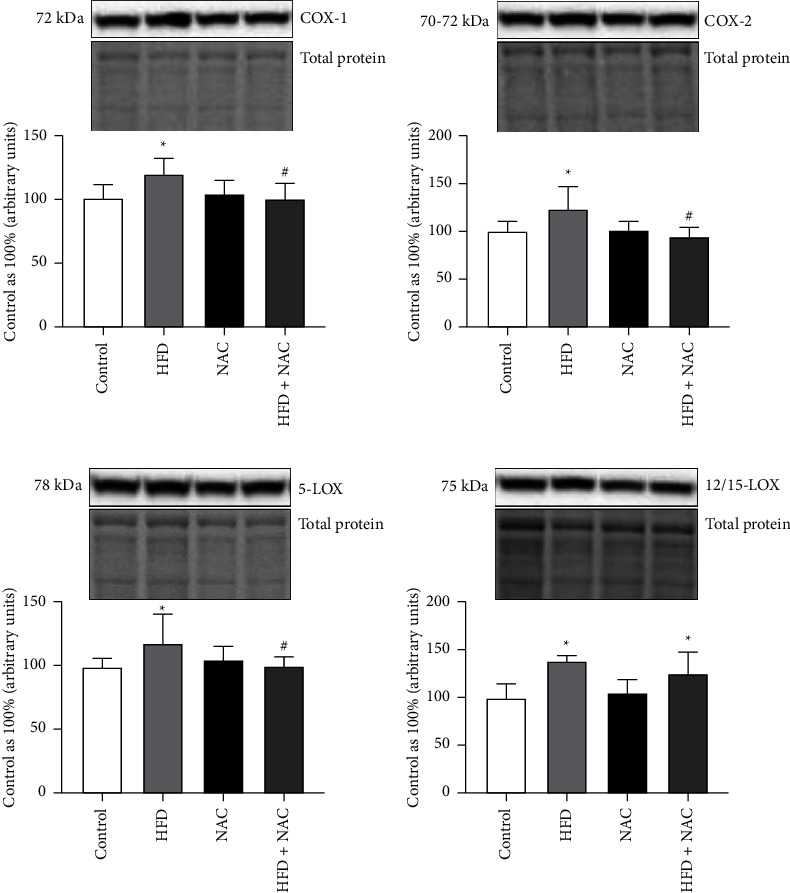 N-Acetylcysteine Decreases Myocardial Content of Inflammatory Mediators Preventing the Development of Inflammation State and Oxidative Stress in Rats Subjected to a High-Fat Diet.