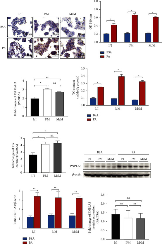 PNPLA3 148M/M Is More Susceptible to Palmitic Acid-Induced Endoplasmic Reticulum Stress-Associated Apoptosis in HepG2 Cells.