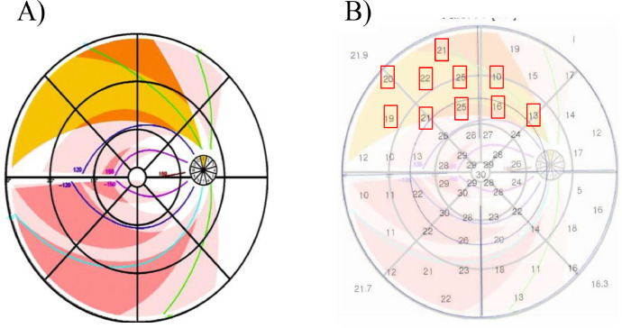 On the protective role of the blood vessels in glaucomatous damage: A transversal study