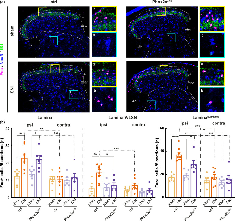 Genetic evidence of the function of Phox2a-expressing anterolateral system neurons in the transmission of chronic pain.