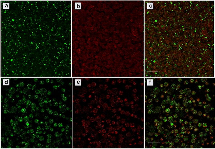 PLGA microparticle formulations for tunable delivery of a nano-engineered filamentous bacteriophage-based vaccine: in vitro and in silico-supported approach.