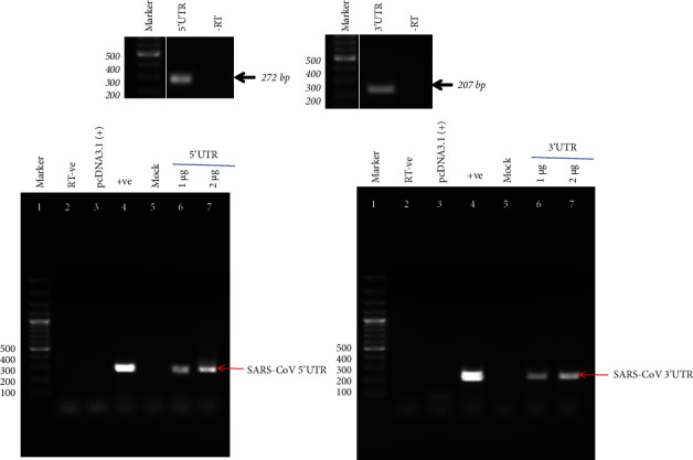 The SARS-CoV-2 UTR's Intrudes Host RBP's and Modulates Cellular Splicing.