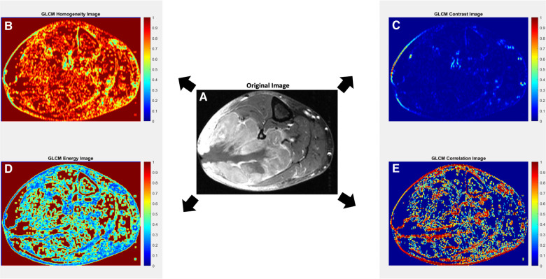 Spatial assessments in texture analysis: what the radiologist needs to know.