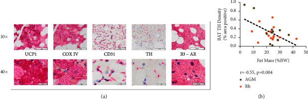 Brief Communication: Histological Assessment of Nonhuman Primate Brown Adipose Tissue Highlights the Importance of Sympathetic Innervation.