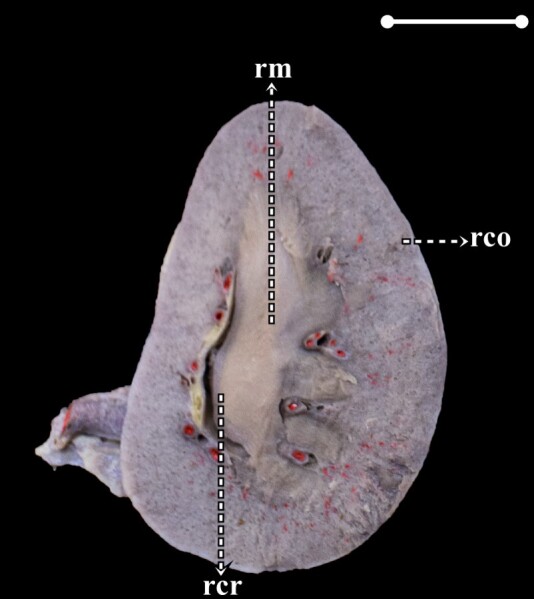 Morphometry and skeletopy of kidneys and renal vessels in <i>Alouatta guariba clamitans</i> (Primates: Atelidae): case reports.