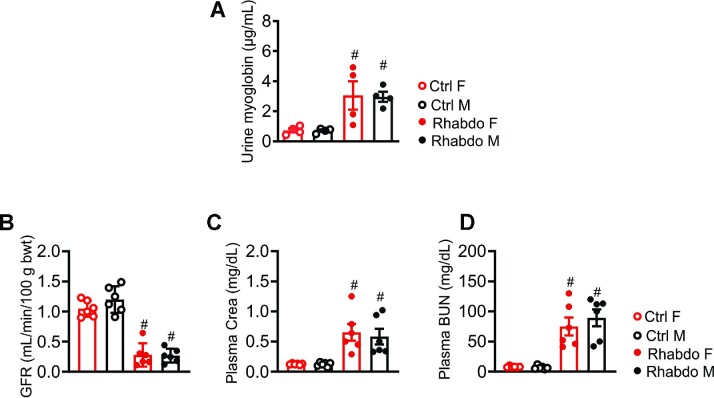 Post-injury Inhibition of Endothelin-1 Dependent Renal Vasoregulation Mitigates Rhabdomyolysis-Induced Acute Kidney Injury.