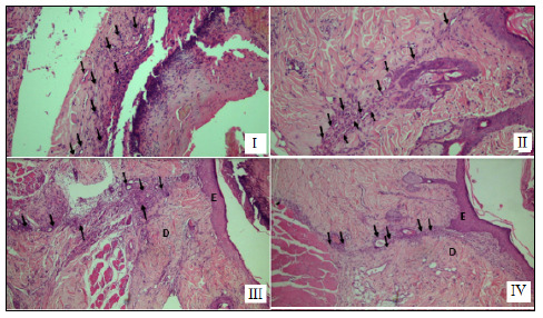 COMPARATIVE EVALUATION OF SKIN SUTURE IN RATS WITH POLYGLYCAPRONE 25 AND NYLON.