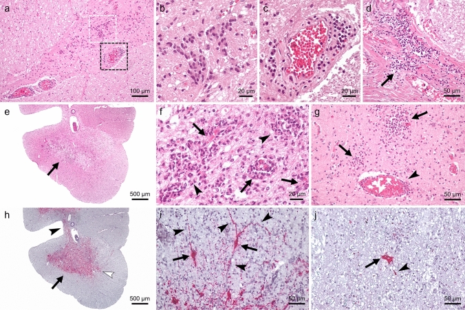 Archival wild-type poliovirus 1 infected central nervous system tissues of the pre-vaccination era in Switzerland reveal a distinct virus genotype