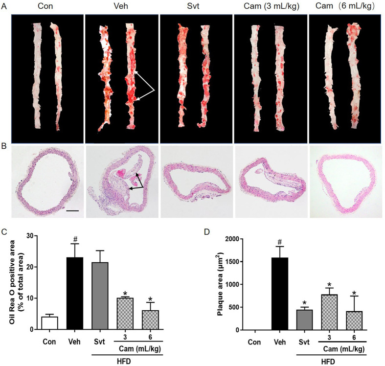 Camellia oil (<i>Camellia oleifera</i> Abel.) treatment improves high-fat diet-induced atherosclerosis in apolipoprotein E (ApoE)<sup>-/-</sup> mice.