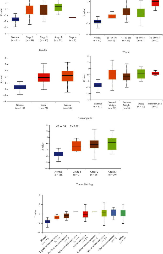 Effect of PTGES3 on the Prognosis and Immune Regulation in Lung Adenocarcinoma.