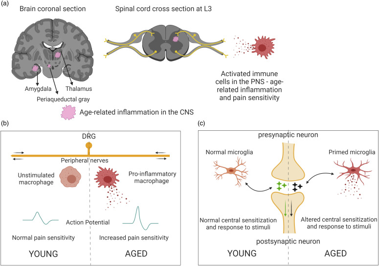 Pain and aging: A unique challenge in neuroinflammation and behavior.