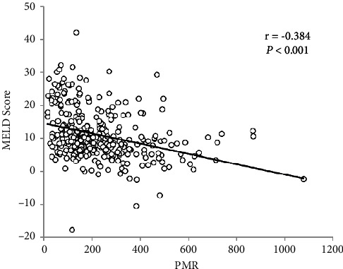 Platelet-to-Monocyte Ratio as a Novel Promising Agent for the Prognosis of Hepatitis B Virus-Associated Decompensated Cirrhosis.