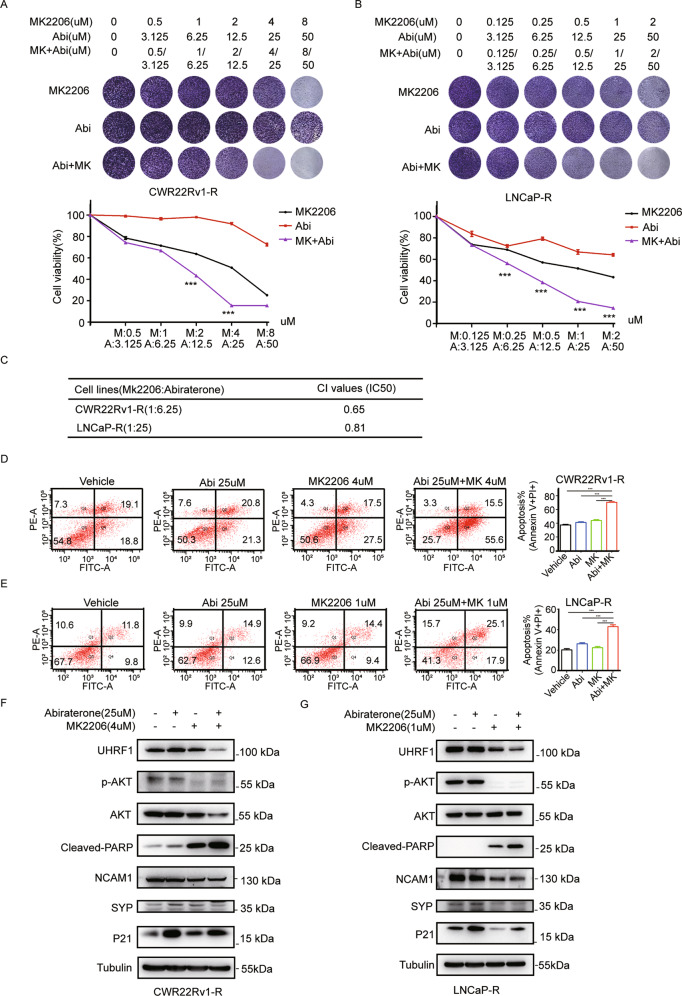 AKT1 regulates UHRF1 protein stability and promotes the resistance to abiraterone in prostate cancer.