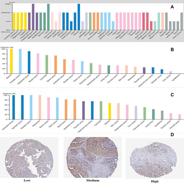 The Prognostic Role of HuR Varies Between Different Subtypes of Breast Cancer Patients: Data Mining and Retrospective Analysis.