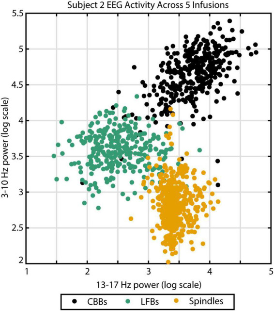 Diversity of electroencephalographic patterns during propofol-induced burst suppression.