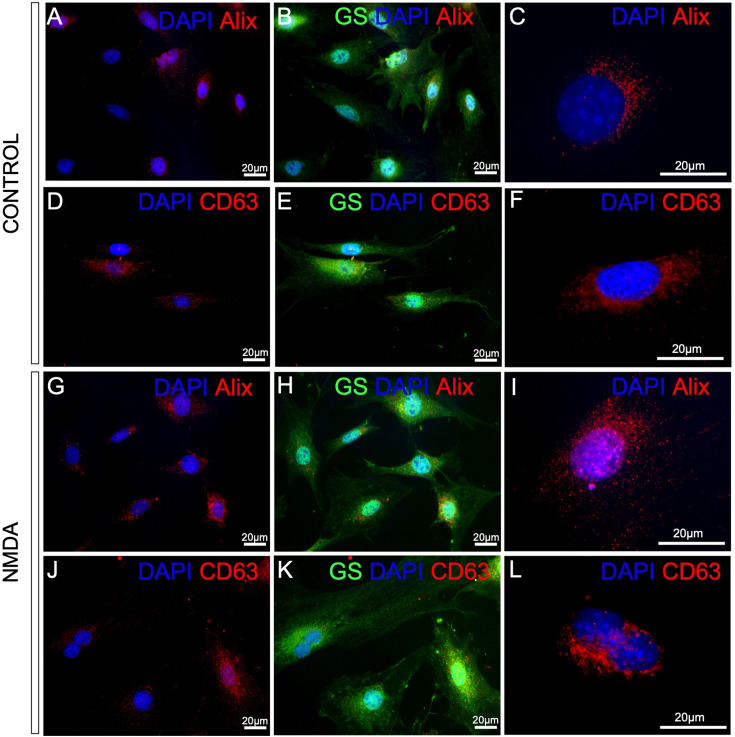 Müller Glia to Müller Glia Extracellular Vesicle-Dependent Signaling Induces Multipotency Genes <i>Nestin</i> and l<i>in28</i> Expression in Response to N-methyl-D-aspartate (NMDA) Exposure.