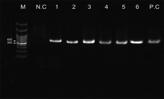 Detection of Opportunistic Fungi from the Bronchoalveolar Lavage Specimens of Patients with Pulmonary Diseases.