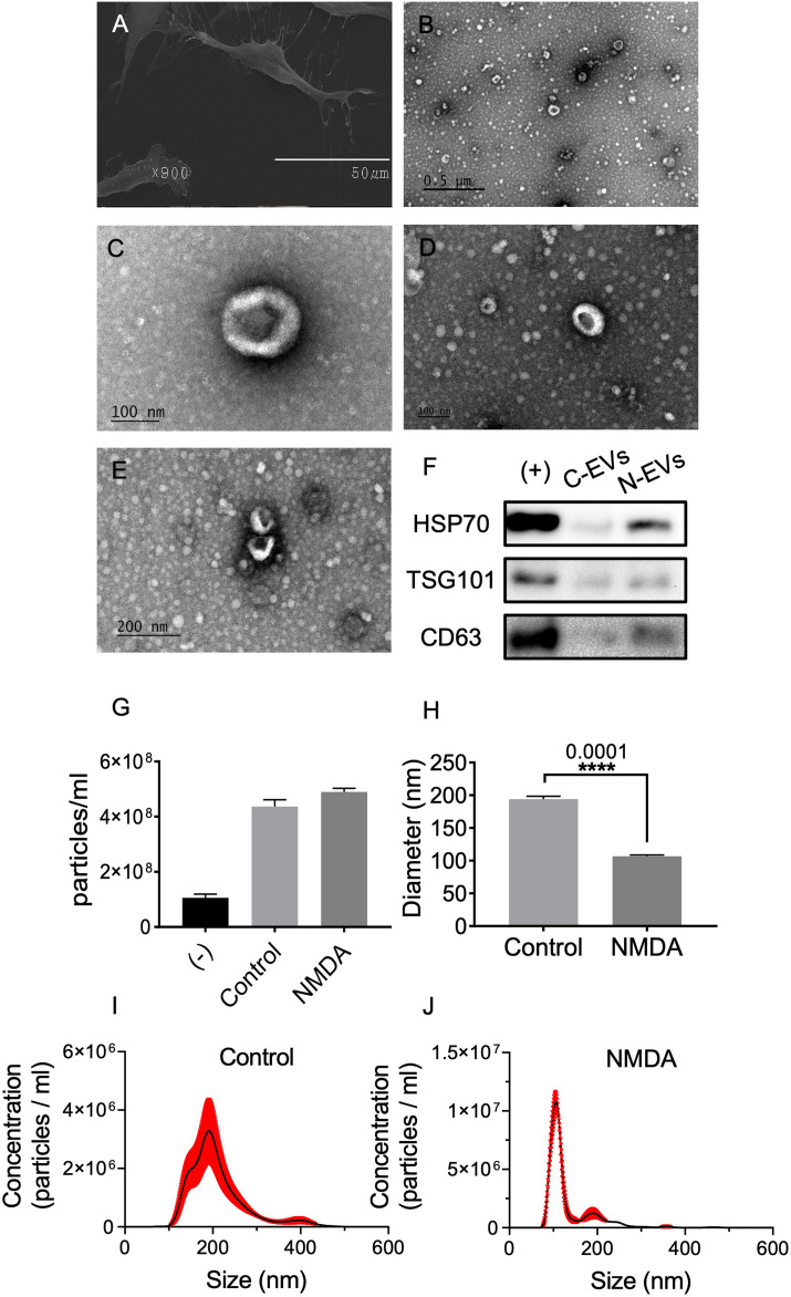 Müller Glia to Müller Glia Extracellular Vesicle-Dependent Signaling Induces Multipotency Genes <i>Nestin</i> and l<i>in28</i> Expression in Response to N-methyl-D-aspartate (NMDA) Exposure.