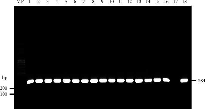 Molecular Detection of Virulence Factors in <i>Salmonella serovars</i> Isolated from Poultry and Human Samples.