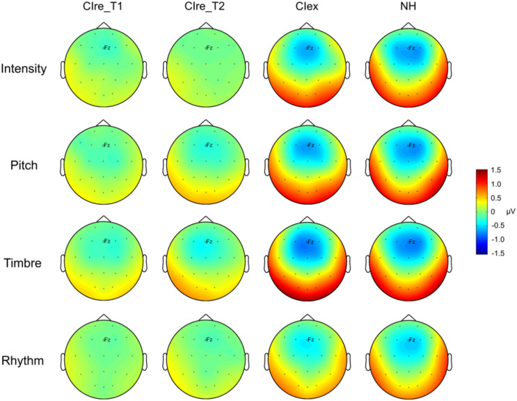 Adapting to the Sound of Music - Development of Music Discrimination Skills in Recently Implanted CI Users.