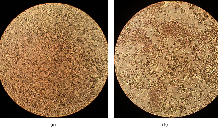 Development and Validation of Rapid Colorimetric Reverse Transcription Loop-Mediated Isothermal Amplification for Detection of Rift Valley Fever Virus.