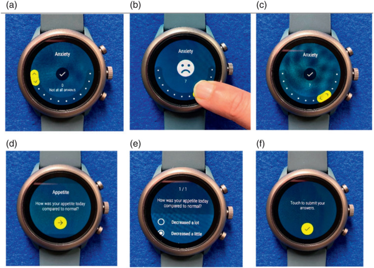 Examining the variability of multiple daily symptoms over time among individuals with multiple long-term conditions (MLTC-M/multimorbidity): An exploratory analysis of a longitudinal smartwatch feasibility study.