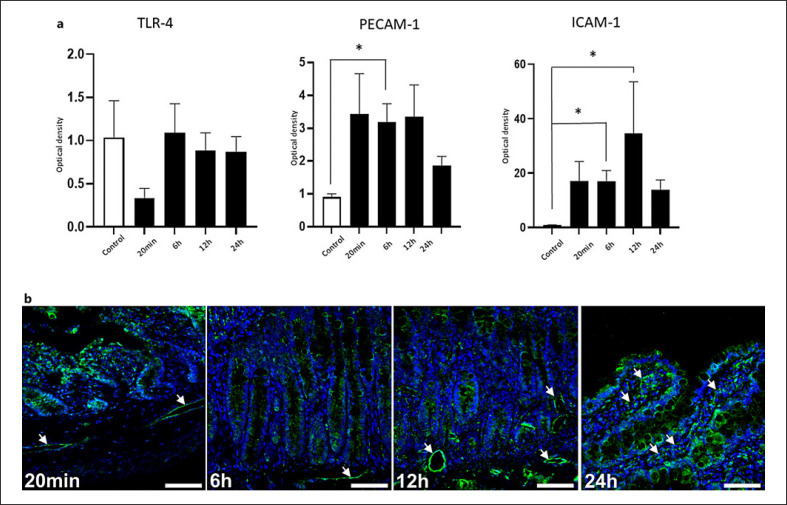 Mucosal Recovery after Intestinal Transplantation in the Rat: A Sequential Histological and Molecular Assessment.