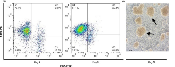 Chemo-immune cell therapy by intratumoral injection of adoptive NK cells with capecitabine in gastric cancer xenograft model.