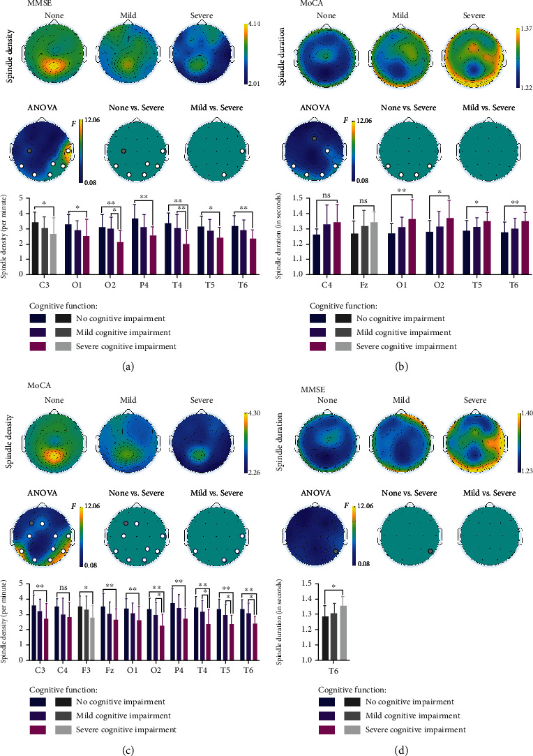 Assessment of Cognitive Function with Sleep Spindle Characteristics in Adults with Epilepsy.