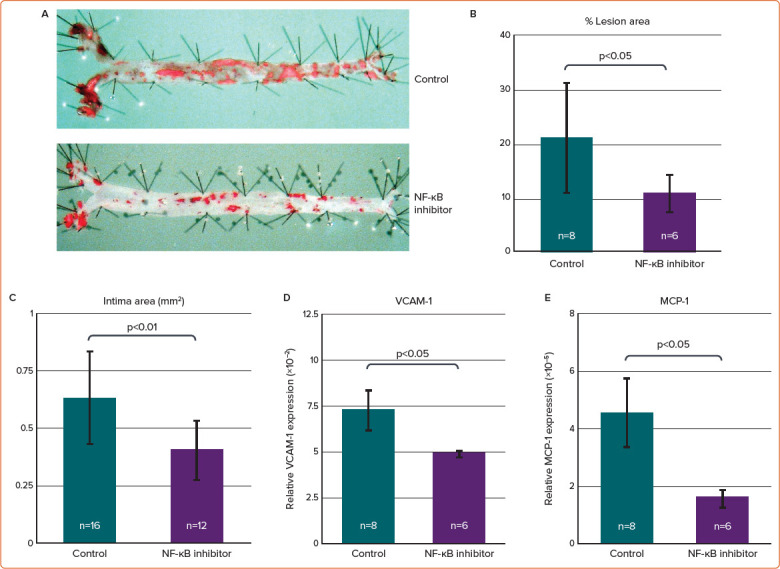 Nuclear Factor-κB is a Prime Candidate for the Diagnosis and Control of Inflammatory Cardiovascular Disease.