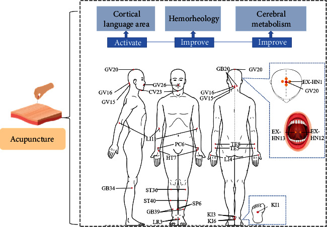 Possible Effects of Acupuncture in Poststroke Aphasia.