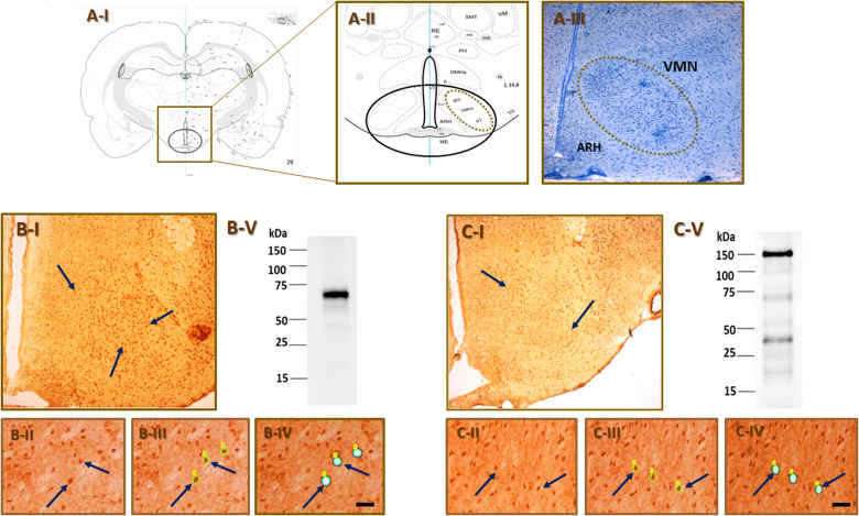 Sex-Dimorphic Octadecaneuropeptide (ODN) Regulation of Ventromedial Hypothalamic Nucleus Glucoregulatory Neuron Function and Counterregulatory Hormone Secretion.